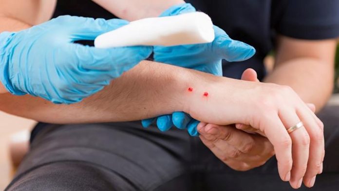 taller accidentes ofídicos Montalbán - Noticias Valle Alto